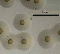 5. 早期発見・治療の重要性